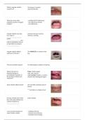 Dental Hygiene OSCE  Oral Pathology Exam