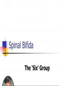 spina bifida