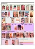 Spiekbrief dermatologie