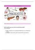 Samenvatting Pancreatitis