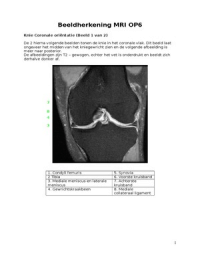 Beeldherkenning OP6 (MRI, CT, EC en AG)