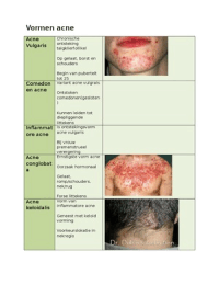 Overzichtelijk schema van vormen acne