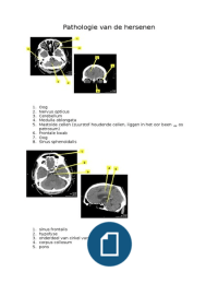 Hersenbloedingen en anatomie uitwerking