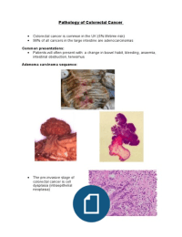 Pathology of Colorectal Cancer 