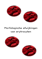 Morfologische afwijkingen van rode bloedcellen