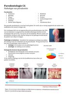 Parodontologie college 6: Pathologie van parodontitis
