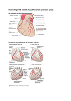 Acuut coronair syndroom (ACS): hartinfarct 