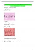 ECG RHYTHM REVIEW &lpar;2024&sol;2025&rpar; 2ND EDITION VERSION 100&percnt; CORRECT AND 5 STAR REVIEWED