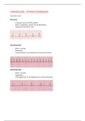 Ritmestoornissen - cardiologie