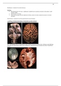 Deel 2 Neuroanatomie, H4 Overzicht vh zenuwstelsel