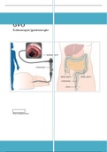 GVO colon/gastroscopie