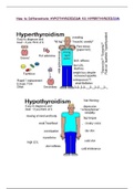 Hypothyroidism VS Hyperthyroidism
