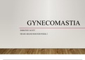 NR 602 Week 2 Pediatric Grand Rounds Presentation: GYNECOMASTIA; complete latest A+ guide.