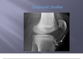 NR 602 Week 2 Pediatric Grand Rounds Presentation and Discussion: OSGOOD-SCHLATTER Disease (Spring 2020) complete solution Guide.