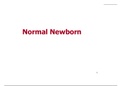 NEW BORN COMPREHENSIVE NOTES FROM STEPS IN BIRTH, MIDWIFE, IMMEDIATE ESSENTIAL CARE FOR NEW BORN, BREASTFEEDING, TO DRUGS