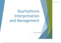 NR 340 Dysrhythmia Interpretation and Management
