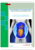 Verslag over Collitis Ulcerosa