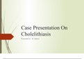 Case study on cholelithiasis