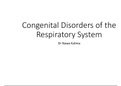 congenital disorders of the respiratory system