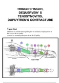 ALL YOU NEED TO KNOW about TRIGGER FINGER, DEQUERVEIN’ S TENOSYNOVITIS, DUPUYTREN’S CONTRACTURE - Medical School