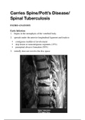 ALL YOU NEED TO KNOW about Spinal Tuberculosis - Medical School
