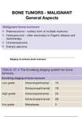 ALL YOU NEED TO KNOW about MALIGNANT BONE TUMORS General Aspects - Medical School