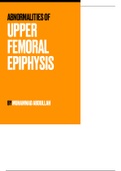 ALL YOU NEED TO KNOW about ABNORMALITI ES OF UPPER FEMORAL EPIPHYSIS - Medical School