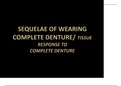 procedure for complete denture impression 2