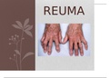 Reuma Powerpoint voor je anatomie reuma toets