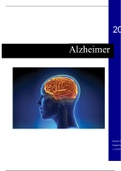 MBZ - Alzheimer