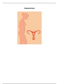 Verslag:  Wat is endometriose?