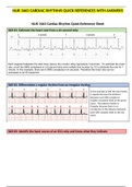 NUR 3463 CARDIAC RHYTHMS QUICK REFERENCES WITH ANSWERS / NUR3463 CARDIAC RHYTHMS QUICK REFERENCES WITH ANSWERS| LATEST 2020:RASMUSSEN COLLEGE (100% SATISFACTIONS)