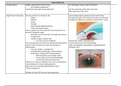Ophthalmology Block Chart