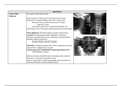 Orthopedics Block Chart - Spine & Upper Extremity