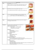 Pressure Ulcer Chart