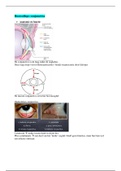 Samenvatting oogheelkundige pathologie- oogheelkunde