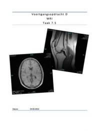 SB5 - Voortgangsopdracht D - MRI