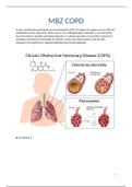 MBZ Diabetes en COPD