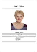 UNFOLDING Reasoning Case Study:  Heart Failure, JoAnn Smith, 72 years old (answered)