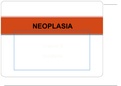 NURSING 321 Neoplasia