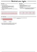 Cardiac Arrhythmias and their ECG interpretation &lpar;Guyton & Hall&rpar;