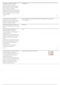 NURS 6630 - Walden University > Case Study&colon; Assessing And Treating Clients With With Bipolar Disorder&semi; Latest 2025 Guide&comma; Already graded A&period;