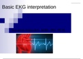 NURSING 2115&comma; Basic EKG interpretation BOOK &vert; Rasmussen College &vert; RATED A