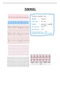 How to read an ECG