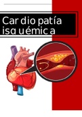 Cardiopatía isquémica