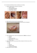 Deramtology skin lesion diagnosis questions