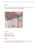 A&P 1 101 Module 7 Exam Integumentary System- Portage Learning