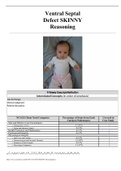Ventral Septal Defect SKINNY Reasoning/Mandy Gray, 2 months old