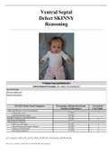 Ventral Septal Defect SKINNY Reasoning&sol;Mandy Gray&comma; 2 months old
