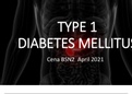 Type 1 Diabetes Mellitus (discussion presentation)